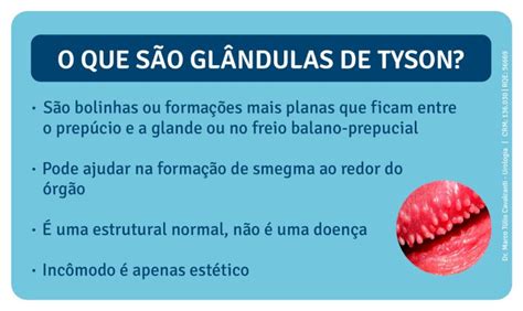 glandula de tyson|Glândulas de Tyson: o que é, causas e sintomas